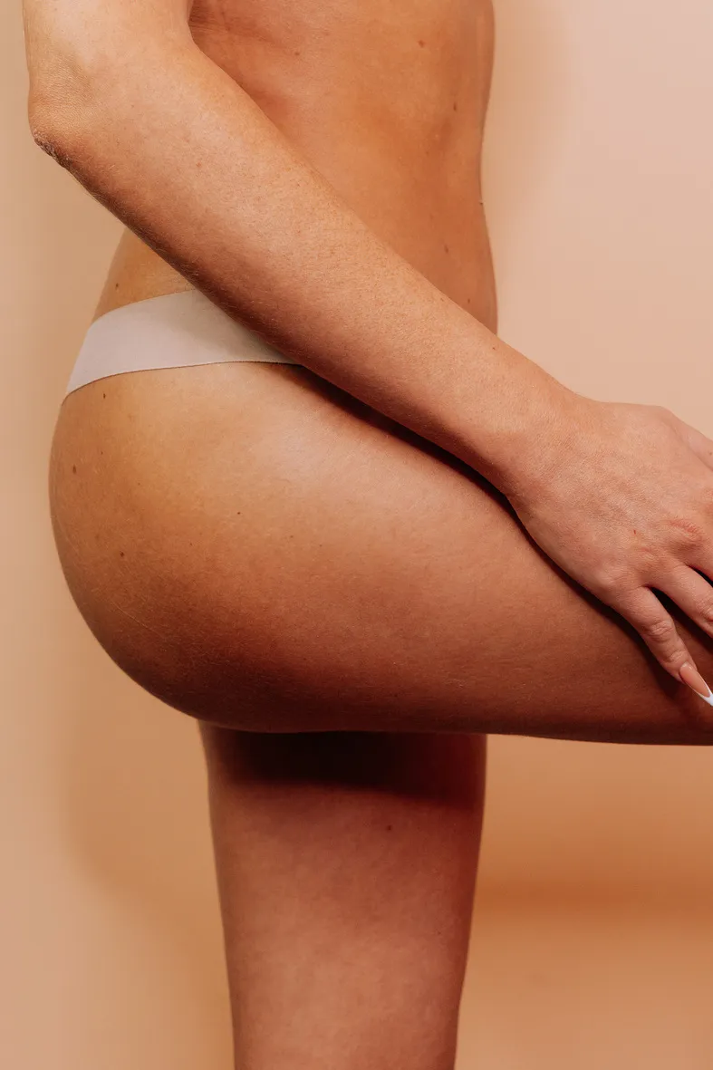 Mesoterapia
