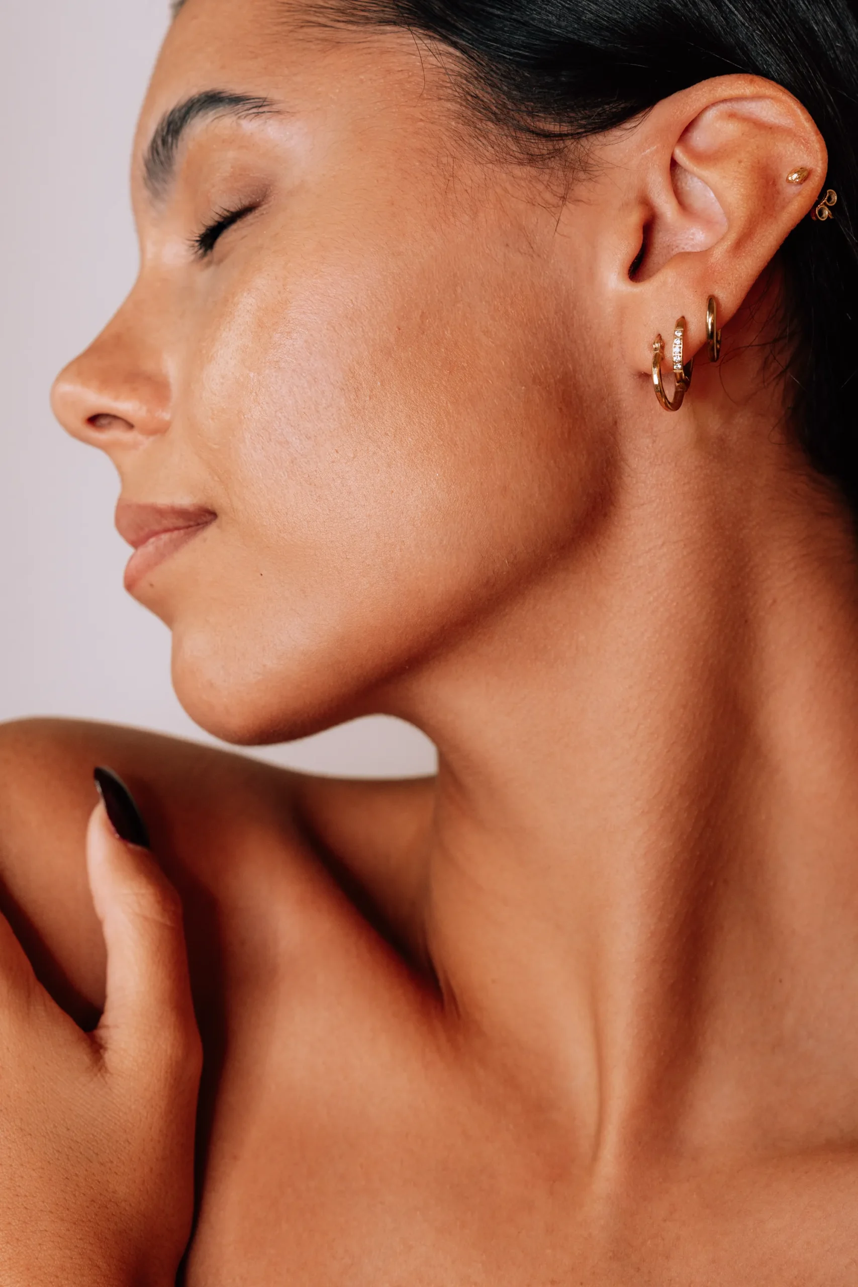 Microneedling